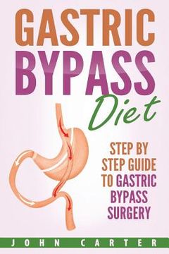 portada Gastric Bypass Diet: Step By Step Guide to Gastric Bypass Surgery 