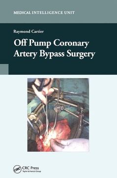 portada Off-Pump Coronary Artery Bypass Surgery