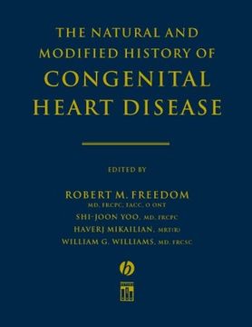 portada The Natural and Modified History of Congenital Heart Disease (en Inglés)