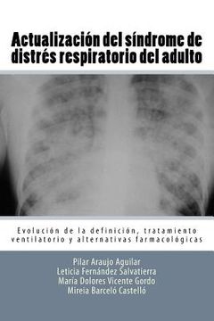portada Actualizacíon del sindrome de distres respiratorio del adulto: Evolucion de la definicion, tratamiento ventilatorio y alternativas farmacologicas