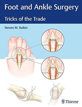portada Foot and Ankle Surgery: Tricks of the Trade (in English)