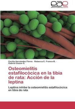 portada Osteomielitis Estafilococica En La Tibia de Rata: Accion de La Leptina