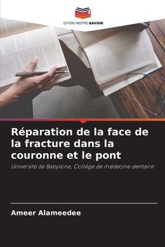 portada Réparation de la face de la fracture dans la couronne et le pont (in French)