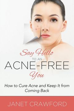 portada Say Hello to an Acne-Free You: How to Cure Acne and Keep it From Coming Back (en Inglés)