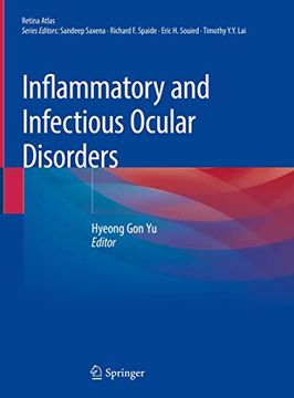portada Inflammatory and Infectious Ocular Disorders (Retina Atlas) (en Inglés)