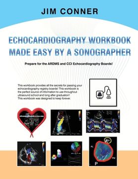 portada Echocardiography Workbook: Echocardiography Made Easy by a Sonographer (en Inglés)