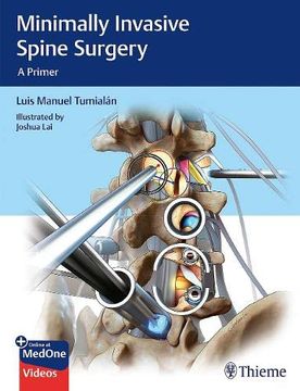 portada Minimally Invasive Spine Surgery: A Primer (in English)