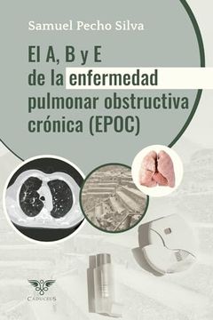 portada El a, b y e de la Enfermedad Pulmonar Obstructiva Crónica (in Spanish)