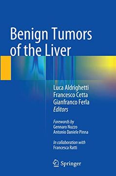 portada Benign Tumors of the Liver (en Inglés)