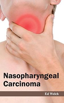 portada Nasopharyngeal Carcinoma (in English)