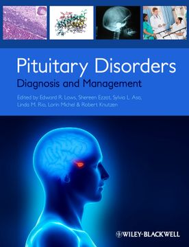 portada Pituitary Disorders: Diagnosis And Management
