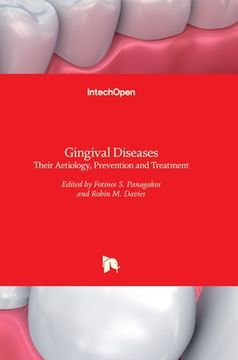 portada Gingival Diseases: Their Aetiology, Prevention and Treatment (en Inglés)