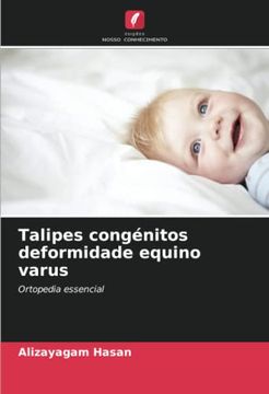 portada Talipes Congénitos Deformidade Equino Varus: Ortopedia Essencial