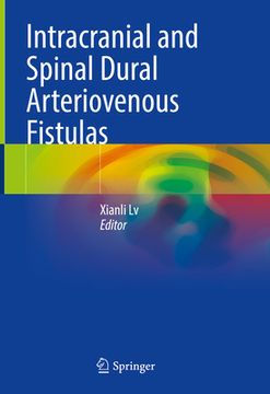 portada Intracranial and Spinal Dural Arteriovenous Fistulas (en Inglés)