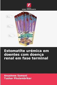 portada Estomatite Urémica em Doentes com Doença Renal em Fase Terminal (en Portugués)