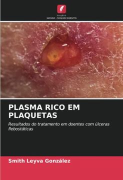 portada Plasma Rico em Plaquetas: Resultados do Tratamento em Doentes com Úlceras Flebostáticas
