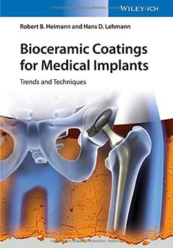 portada Bioceramic Coatings for Medical Implants: Trends and Techniques