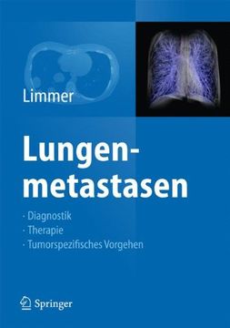 portada Lungenmetastasen (en Alemán)