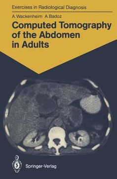 portada computed tomography of the abdomen in adults: 85 radiological exercises for students and practitioners (en Inglés)