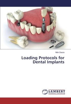 portada Loading Protocols for Dental Implants