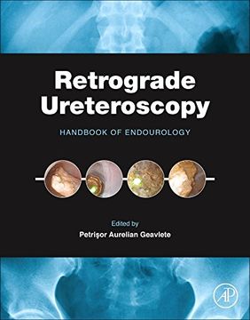 portada Retrograde Ureteroscopy: Handbook of Endourology (en Inglés)