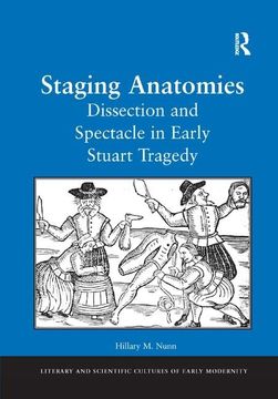 portada Staging Anatomies: Dissection and Spectacle in Early Stuart Tragedy (en Inglés)