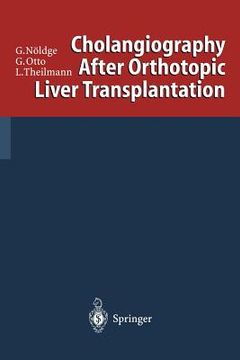 portada cholangiography after orthotopic liver transplantation