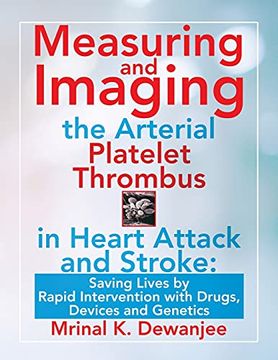 portada Measuring and Imaging the Arterial Platelet Thrombus in Heart Attack and Stroke: Saving Lives by Rapid Intervention With Drugs, Devices and Genetics (en Inglés)