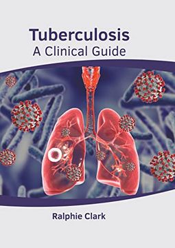 portada Tuberculosis: A Clinical Guide (en Inglés)