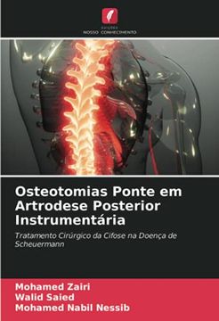 portada Osteotomias Ponte em Artrodese Posterior Instrumentária: Tratamento Cirúrgico da Cifose na Doença de Scheuermann (en Portugués)