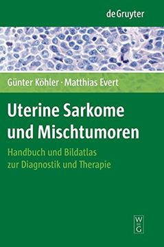 portada Uterine Sarkome und Mischtumoren (en Alemán)