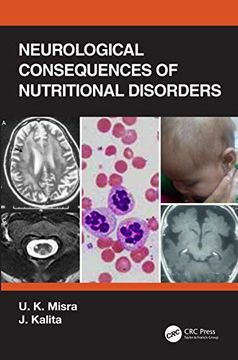 portada Neurological Consequences of Nutritional Disorders 