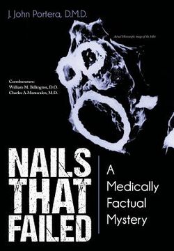 portada Nails That Failed: A Medically Factual Mystery (en Inglés)