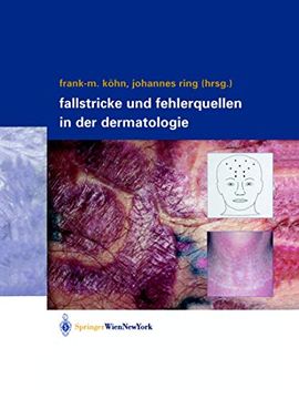 portada Fallstricke Und Fehlerquellen in Der Dermatologie (in German)