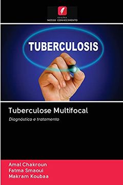 portada Tuberculose Multifocal: Diagnóstico e Tratamento (en Portugués)