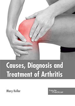 portada Causes, Diagnosis and Treatment of Arthritis