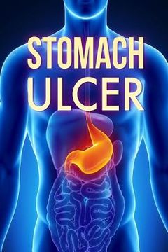 portada Stomach Ulcer: Treatment in 60 days!: Stomach Ulcer treatment