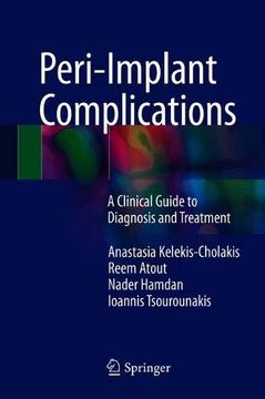 portada Peri-Implant Complications: A Clinical Guide to Diagnosis and Treatment (en Inglés)