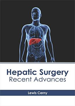 portada Hepatic Surgery: Recent Advances (in English)
