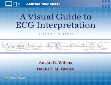 portada A Visual Guide to ECG Interpretation: Print + eBook with Multimedia