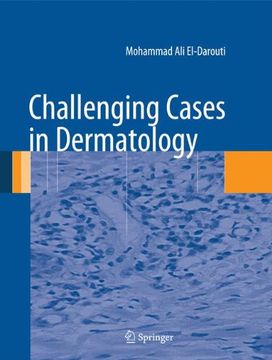 portada challenging cases in dermatology (en Inglés)