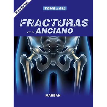 portada Fracturas en el Anciano Handbook (in Spanish)