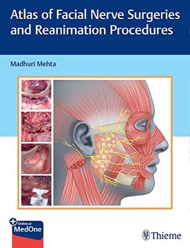 portada Atlas of Facial Nerve Surgeries and Reanimation Procedures (en Inglés)