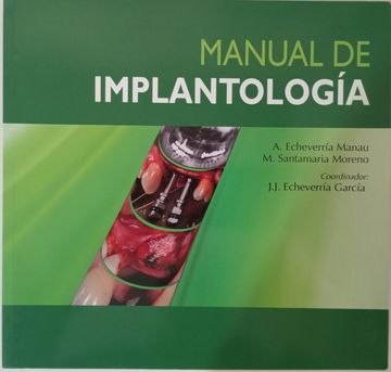 portada Manual de Implantologia