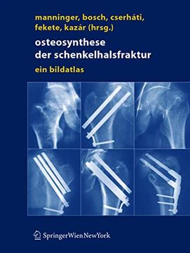 portada Osteosynthese der schenkelhalsfraktur: ein bildatlas (en Alemán)