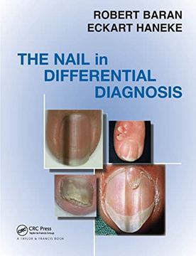 portada Nail in Differential Diagnosis 
