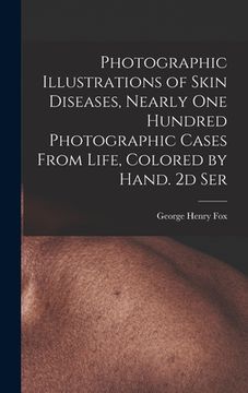 portada Photographic Illustrations of Skin Diseases, Nearly One Hundred Photographic Cases From Life, Colored by Hand. 2d Ser (in English)