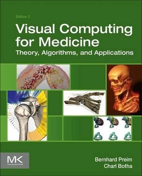 portada Visual Computing for Medicine: Theory, Algorithms, and Applications (The Morgan Kaufmann Series in Computer Graphics)