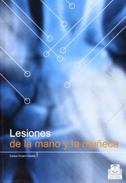 portada Lesiones de la Mano y la Muñeca (in Spanish)