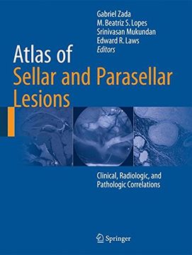 portada Atlas of Sellar and Parasellar Lesions: Clinical, Radiologic, and Pathologic Correlations (en Inglés)